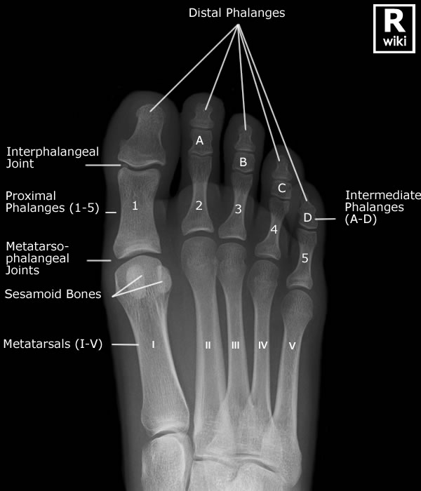Radiographic Anatomy - Toes AP