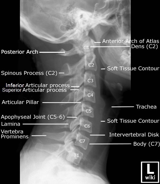 Cervical Spine Radiographic Anatomy - wikiRadiography