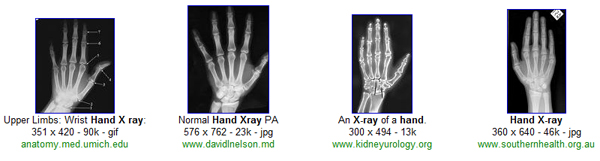 hand radiography