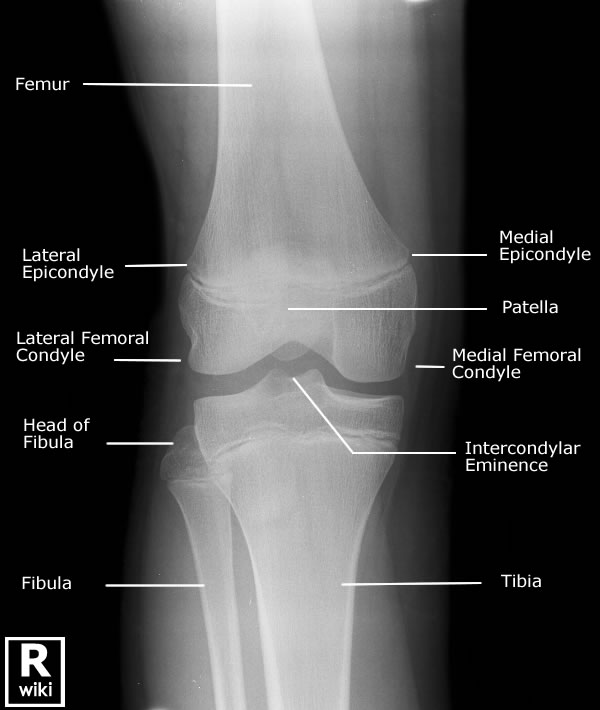 Radiographic Anatomy - Knee AP