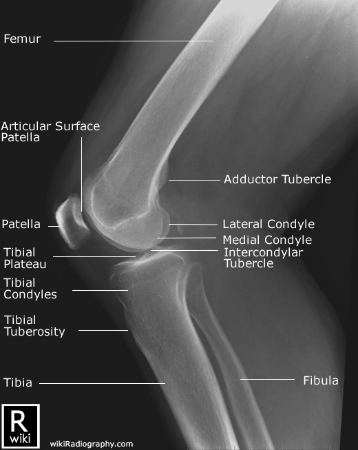 Radiographic Anatomy - Knee - Rolled Lateral