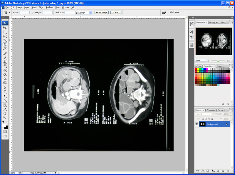 Preparing Images for the Web with Photoshop - wikiRadiography