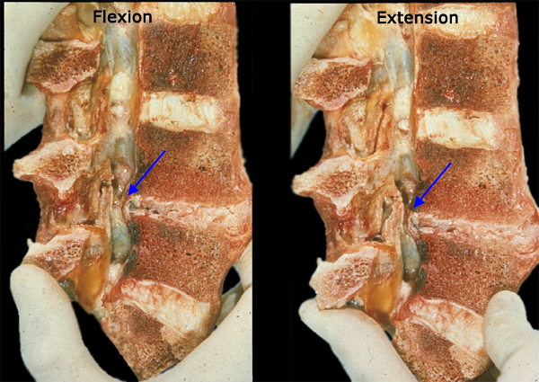 lumbar spine flexion and extension