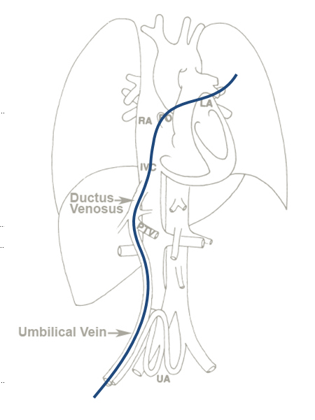 UVC in pulmonary circulation