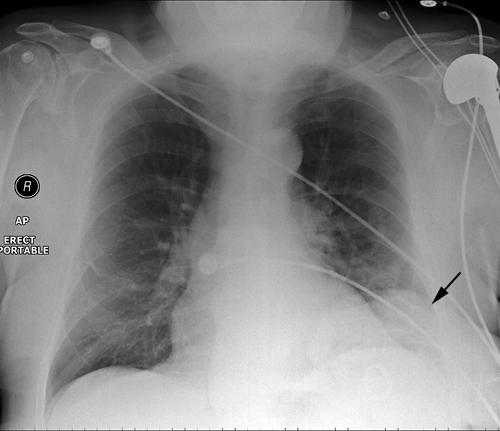 chest radiography