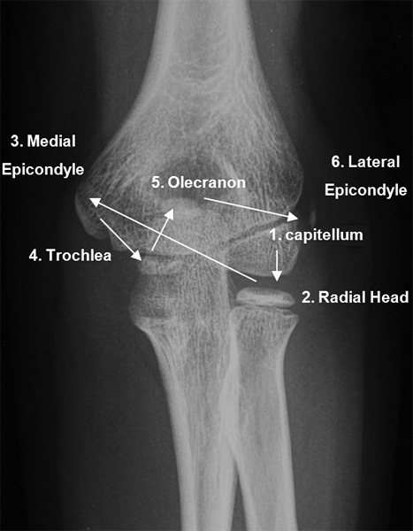 ossification of the elbow