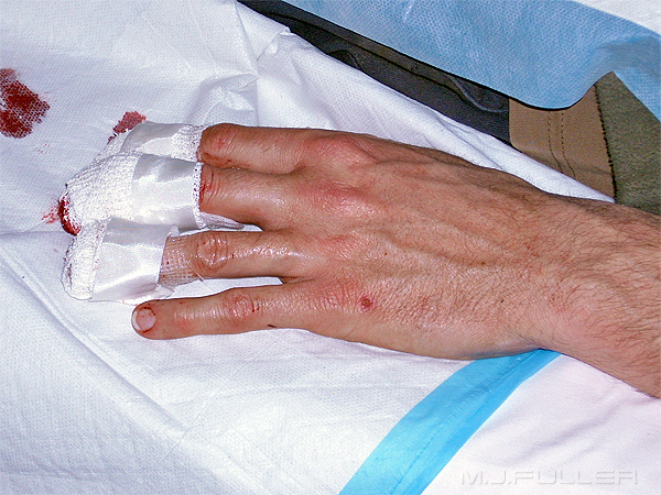 bandaged fingers