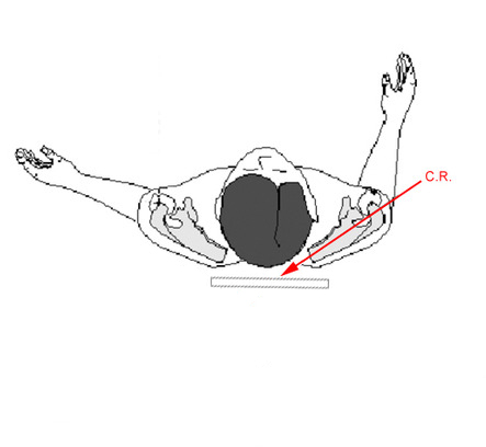 modified lateral scapula technique
