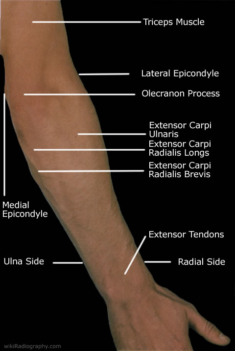 Elbow Forearm WikiRadiography