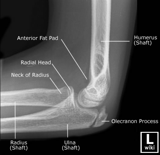 Radiographic Anatomy - Paediatric Elbow - LAT