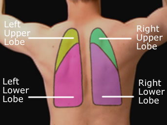 Surface Anatomy - Lungs Posterior