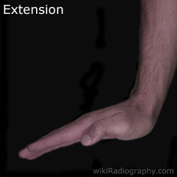 Hand/Wrist - wikiRadiography