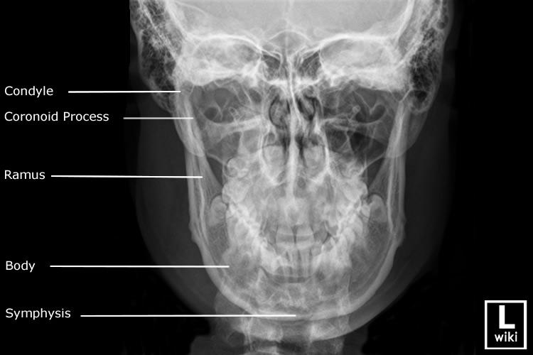 Radiographic Anatomy - Mandible PA