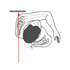 lateral scapula graphic