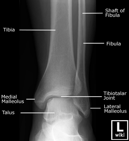 Radiographic Anatomy - Ankle AP