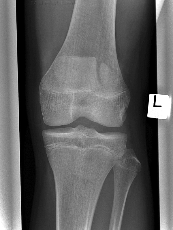 knee case study 1 ap