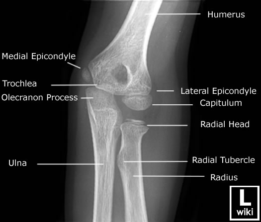 Radiographic Anatomy - Paediatric Elbow - Oblique