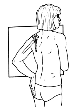 lateral scapula position