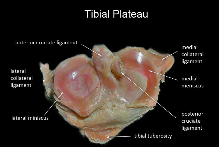 tibial plateau
