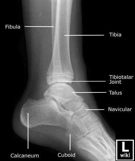 Radiographic Anatomy - Ankle - Lateral