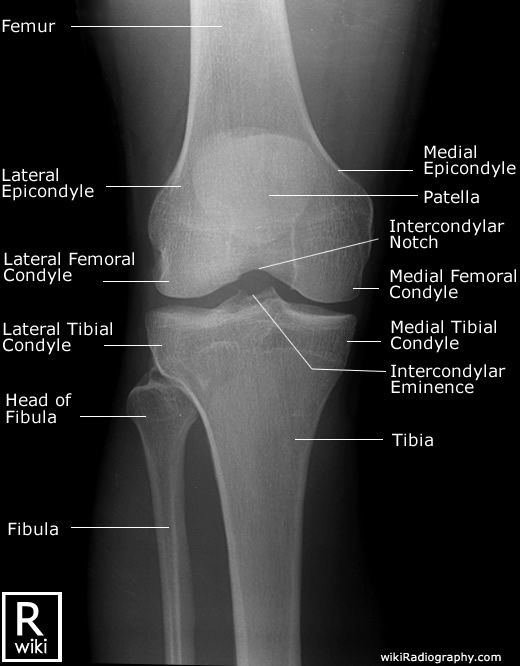 Knee (non trauma) Radiographic Anatomy - wikiRadiography