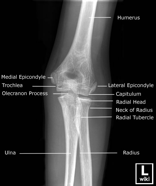 Radiographic Anatomy - Paediatric Elbow - AP