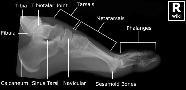 Radiographic Anatomy - Foot Lateral
