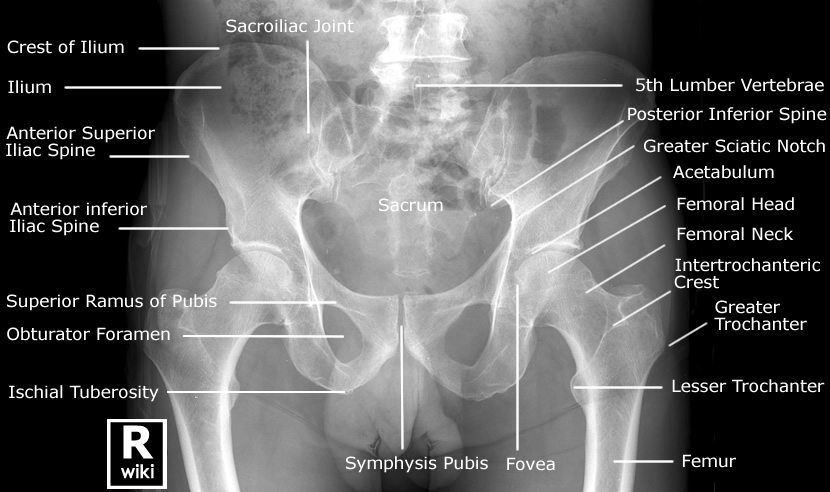 Pelvis Radiographic Anatomy - wikiRadiography