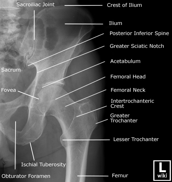 Radiographic Anatomy - Hip AP