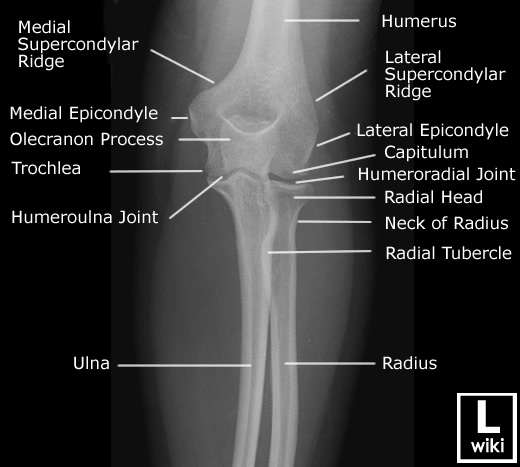 Radiographic Anatomy - Elbow AP