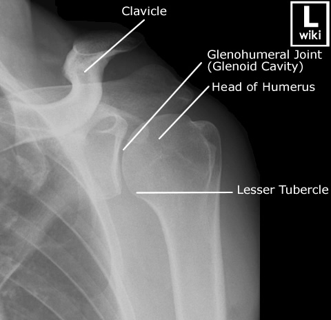Shoulder - GH - Radiographic Anatomy