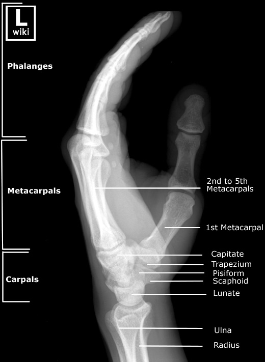 Radiographic Anatomy - Hand Lateral
