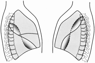 The Fissures of the lung