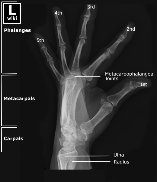 Radiographic Anatomy - Hand Lateral Fanned