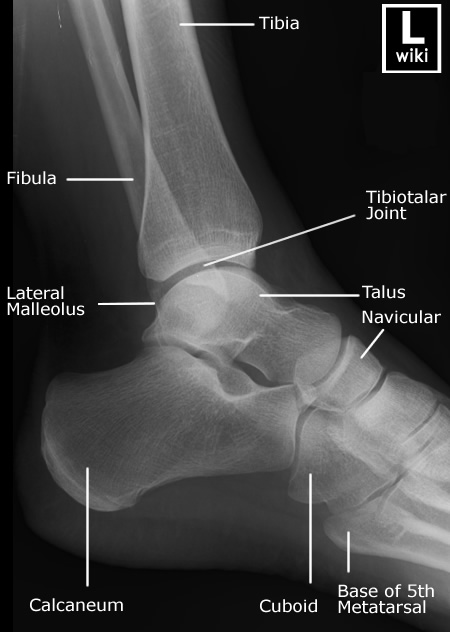 Radiographic Anatomy - Ankle Lateral