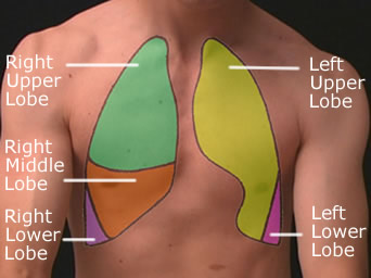 Surface Anatomy - Lungs Anterior