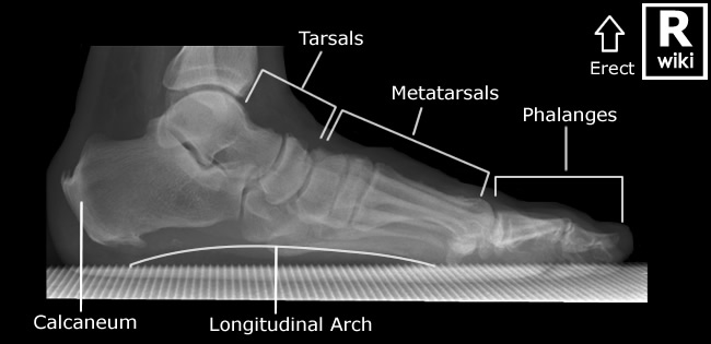 Radiographic Anatomy - Foot Lateral Weight Bearing