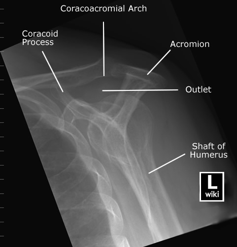 Radiographic Anatomy - Shoulder Neers