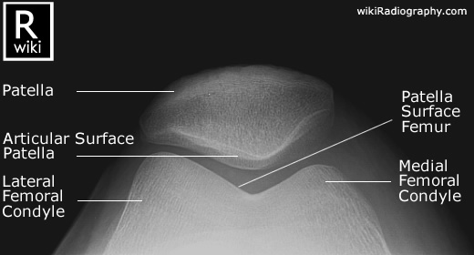 Radiographic Anatomy - Knee - Skyline