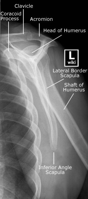 Shoulder Radiographic Anatomy - wikiRadiography