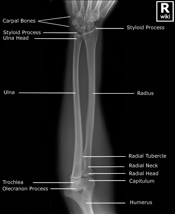 Radiographic Anatomy - Forearm AP
