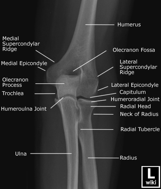 Radiographic Anatomy - Elbow Oblique