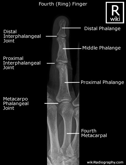 Fourth (Ring) Finger - Oblique - Radiographic Anatomy