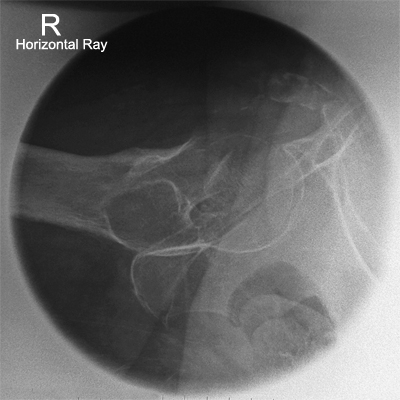 lateral horizontal ray hip