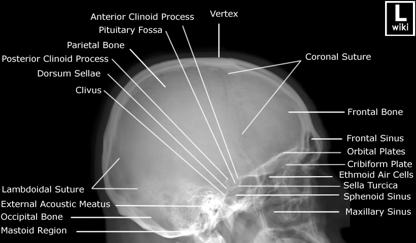 Radiographic Anatomy - Skull Lateral