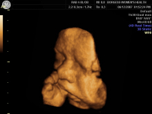 Ultrasound Anatomy - wikiRadiography