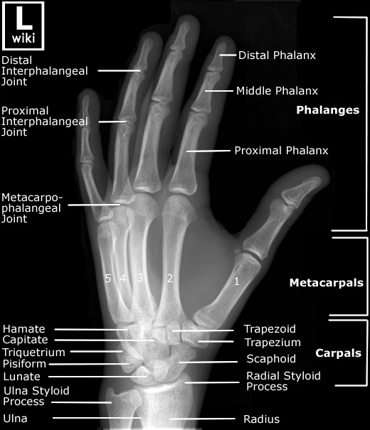 Hand Radiographic Anatomy - wikiRadiography