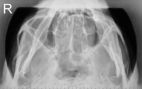 Radiography in the Round - wikiRadiography