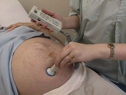 Fetal Heart Beat - Clinical - wikiRadiography