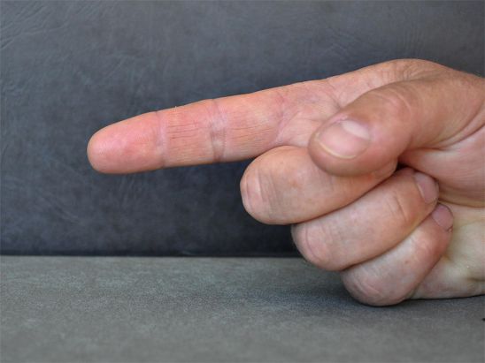 lateral finger technique
